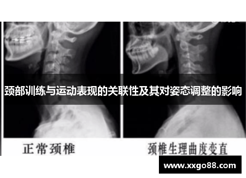 颈部训练与运动表现的关联性及其对姿态调整的影响